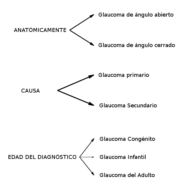 esquema-glaucoma